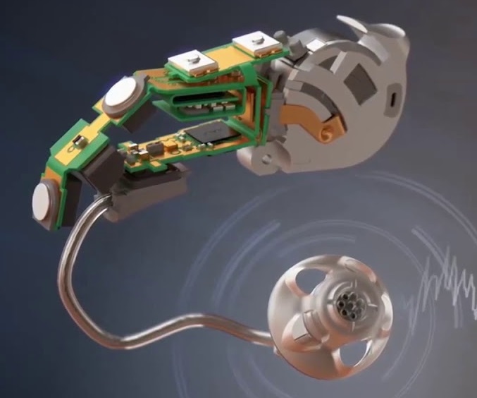 maxresdefault.jpg maxresdefault.jpg